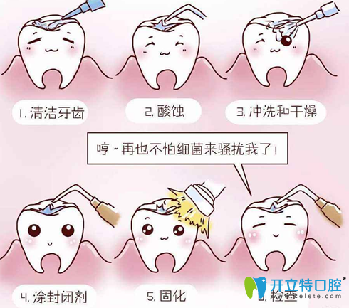 深度揭秘：窩溝封閉是個(gè)騙局?窩溝封閉后更容易爛牙？