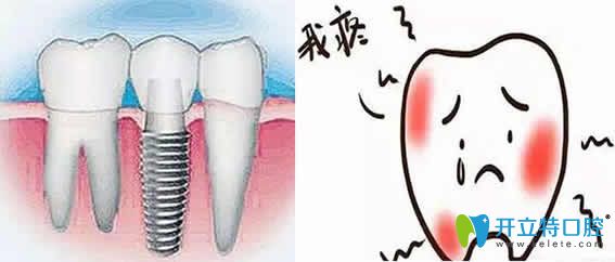 先了解種植牙后牙齦腫痛的原因，再看治療方法