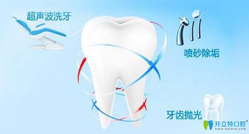 深度揭秘：牙齒噴砂和拋光是什么,哪個更好,價格又是多少?