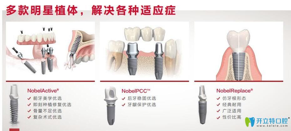 瑞典諾貝爾種植體分哪些型號?nobel cc和active的區(qū)別是什么?