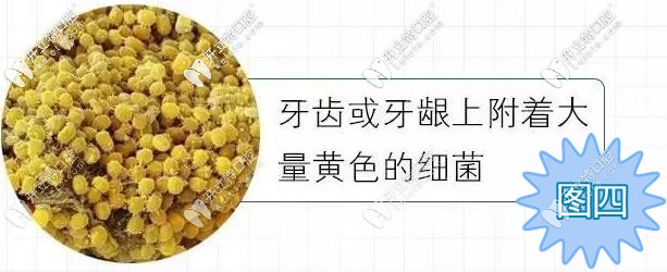 牙齒和牙齦上的細(xì)菌