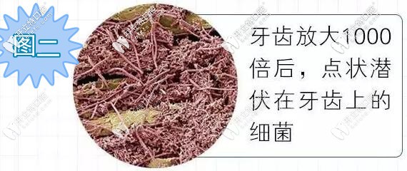 牙齒放大1千倍上面的細(xì)菌