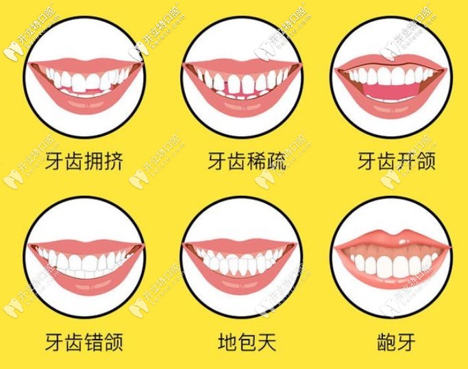 圖片牙齒情況都可以做矯正哦