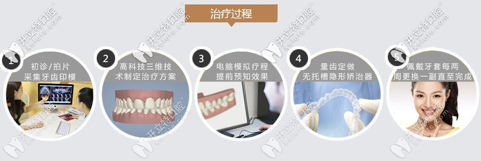 隱形牙齒矯治器矯正過程