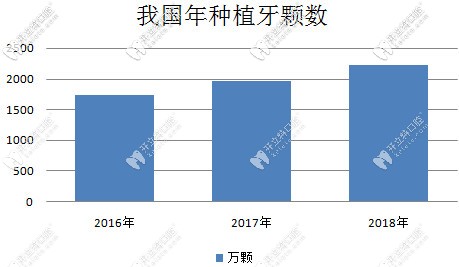 今日解答:滿口牙全掉了選全口即刻負(fù)重和傳統(tǒng)種植牙哪個(gè)好