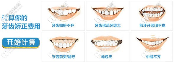 搜集到一份信陽(yáng)伢牙齒科做牙齒矯正的價(jià)格表前來(lái)分享