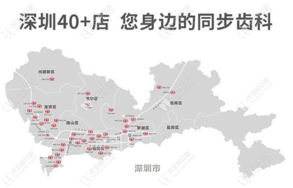 深圳同步齒科分店詳細(xì)地址:含南山及福田區(qū)的40多家分院